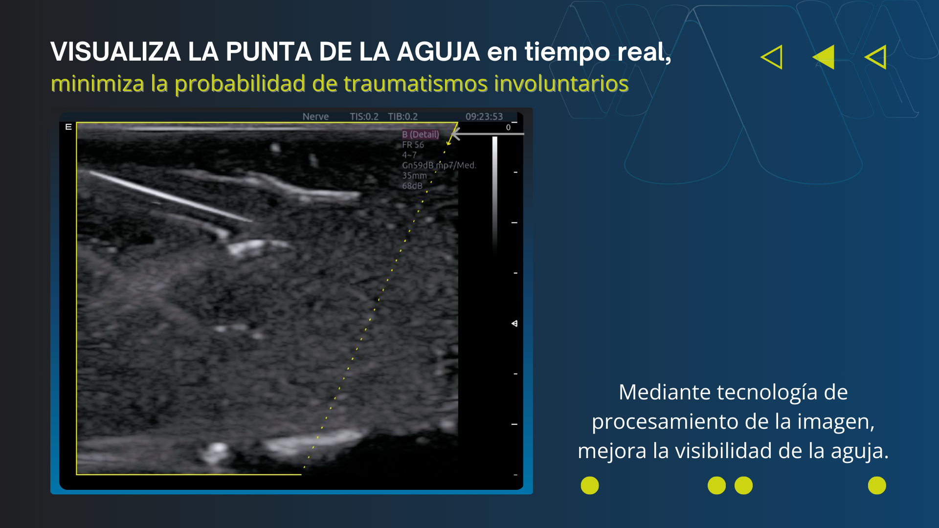 Optimice sus Procedimientos Quirúrgicos (1)